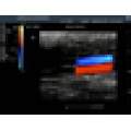 MSLCU25M 2016 Protable Máquina de ultra-som doppler de cor vem com sonda convexa